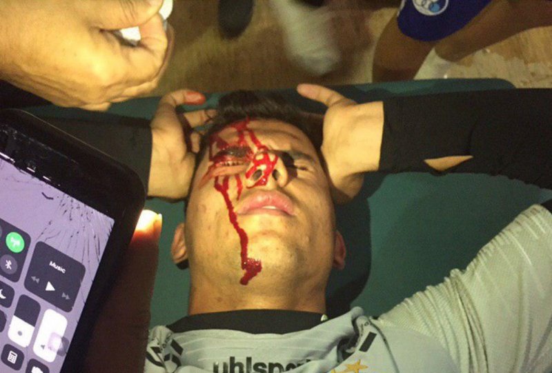 صورت خونین دروازه‌بان استقلال (عکس)