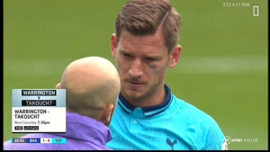 خطر از بیخ گوش مدافع بلژیکی تاتنهام گذشت (عکس)