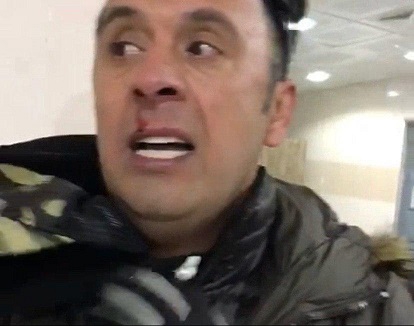 ضرب و شتم شدید مهدی پاشازاده در بوکان