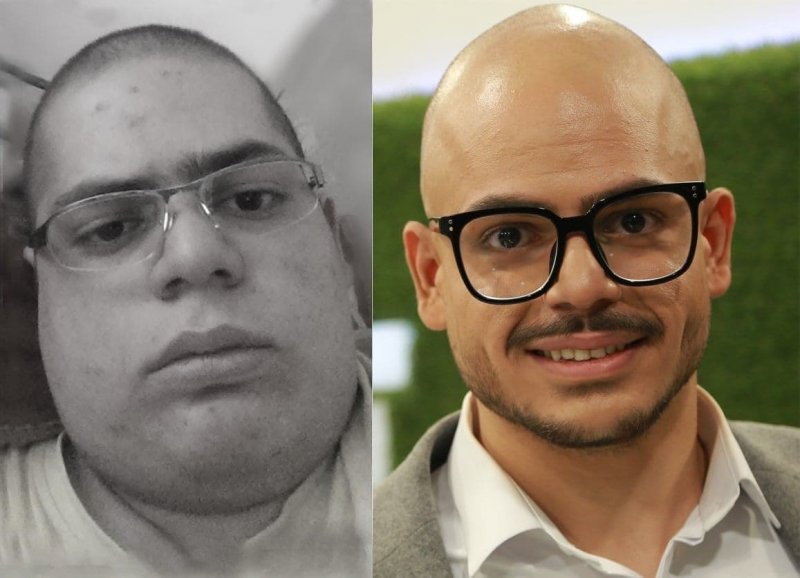 داستان یک بوکسور حرفهای؛ از چاقی مفرط تا امروز