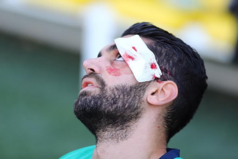 مصدومیت ترسناک علی کریمی (عکس)