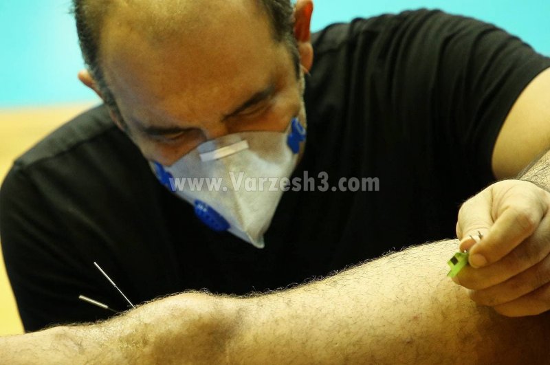 طب سوزنی روی سرباز تیم ملی والیبال (عکس)