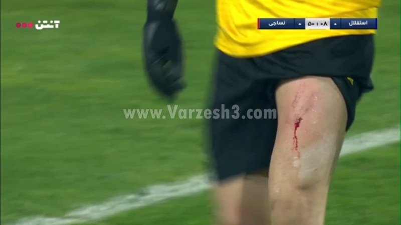 حقیقی خونین و مالین در آزادی! (عکس)