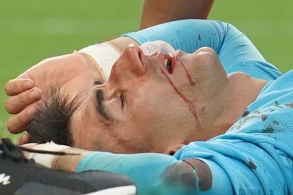 تکرار خاطره بد جام جهانی، بیرانوند به بیمارستان رفت!
