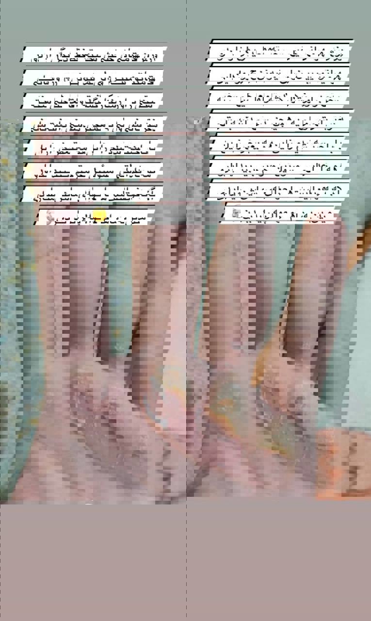 مسئولین دستهای من را ببینند؛/ واکنش تند دختر تاریخساز: به من حواله پراید بدید! 2