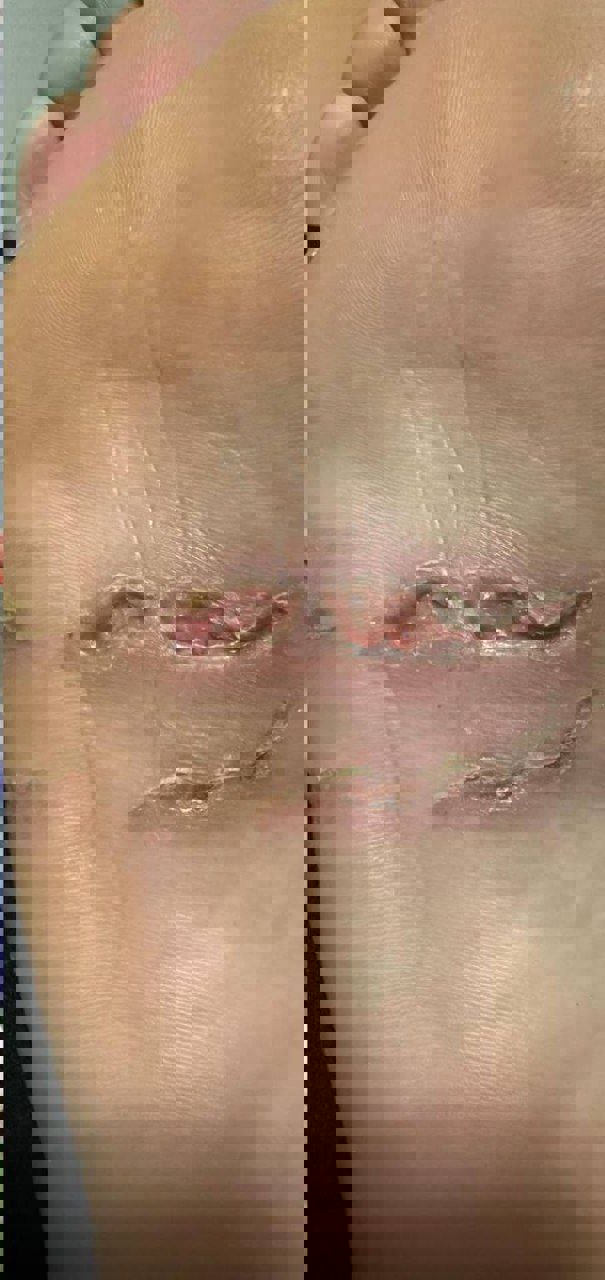 2001306