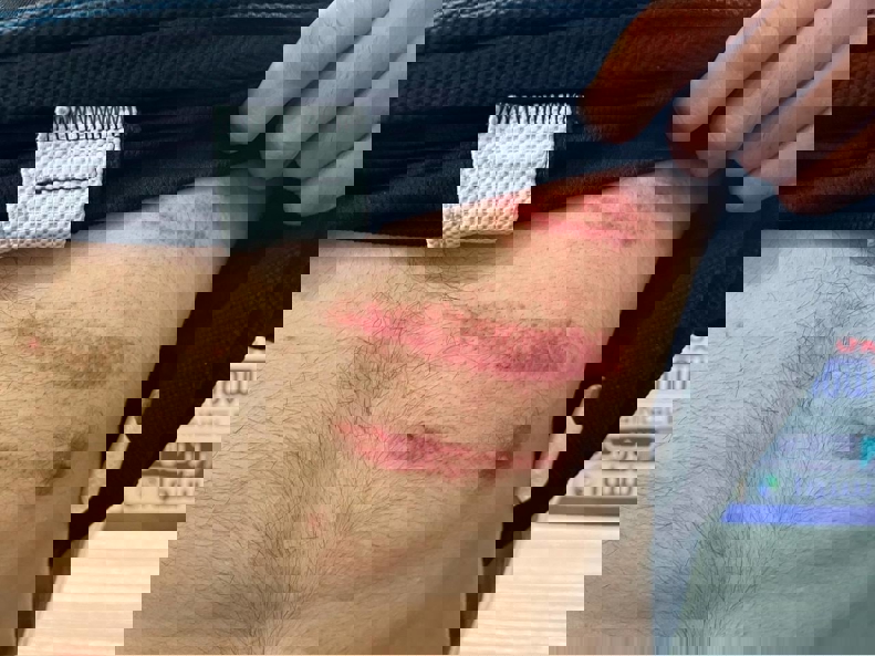 2013741