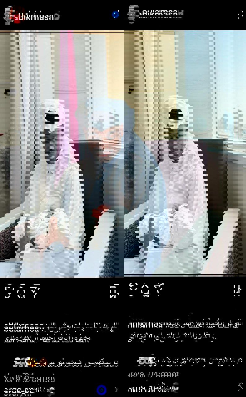 2024707