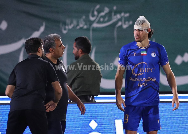 بلانکو این صحنه را بارها مرور میکند (عکس)