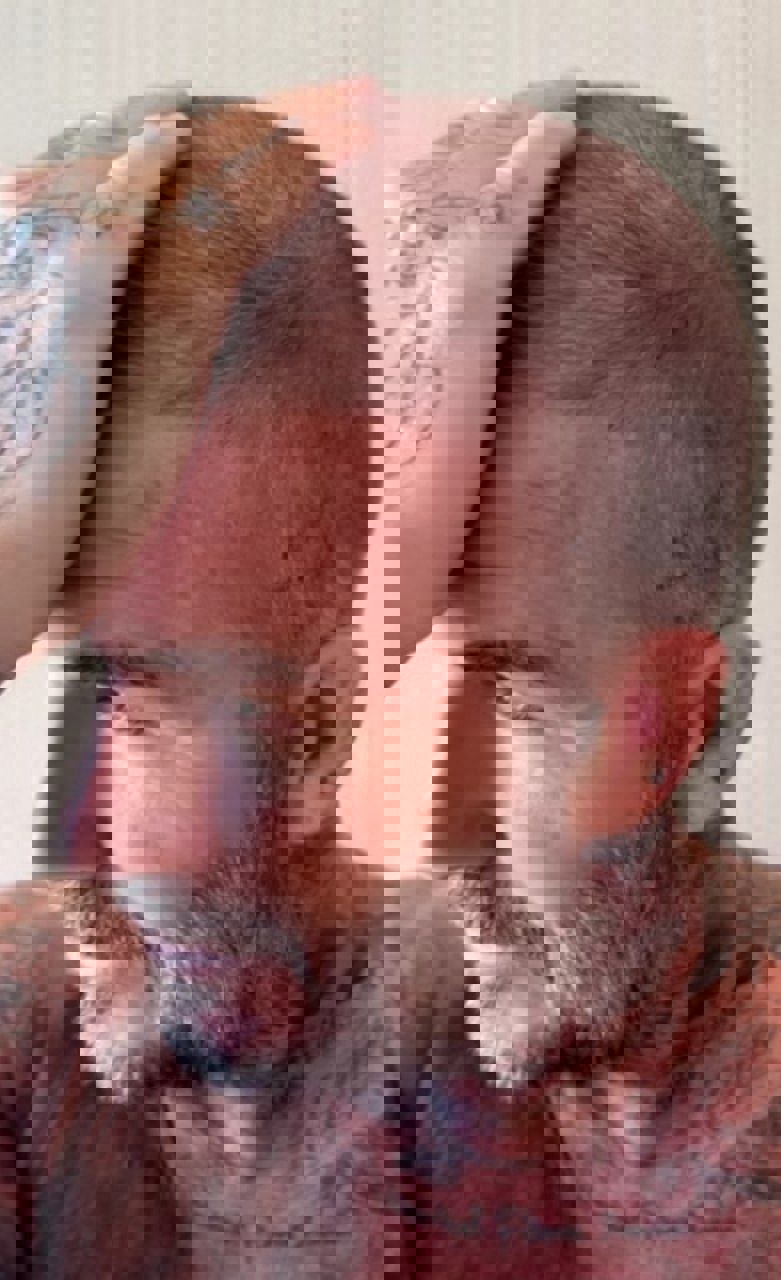 2209915