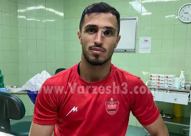 علیپور با صورت شکافته در پرسپولیس! (عکس)