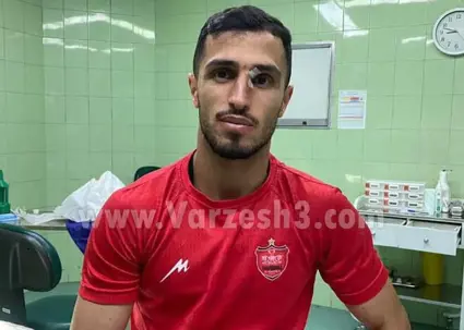 علیپور با صورت شکافته در پرسپولیس! (عکس)