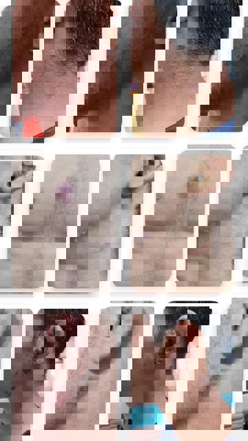 2223624
