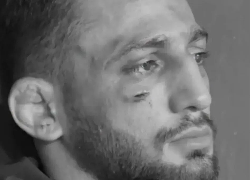 غم جهان در صورت زخمی آذرپیرا(عکس)