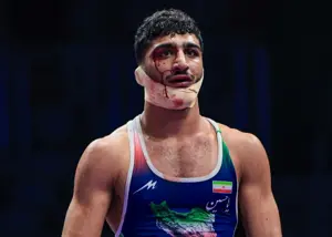 شفاف سازی دکتر شادگان از شکست جنجالی دانیال