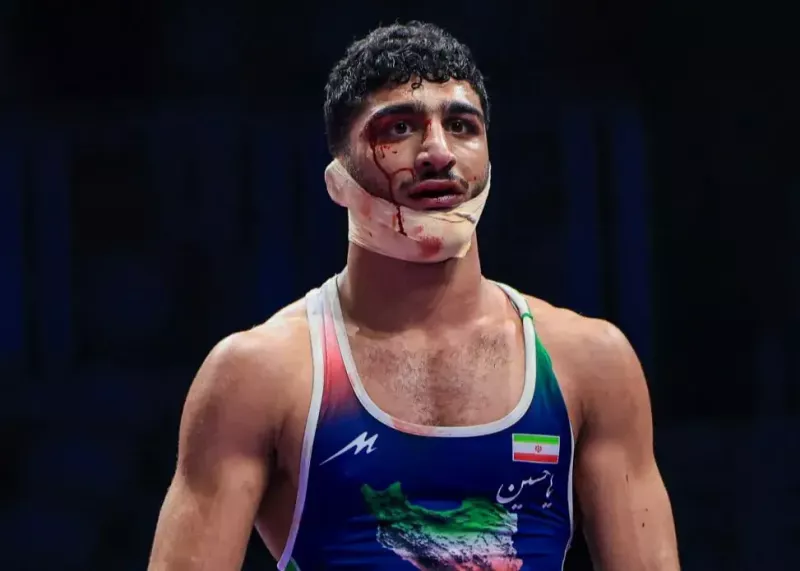 شفاف سازی دکتر شادگان از شکست جنجالی دانیال