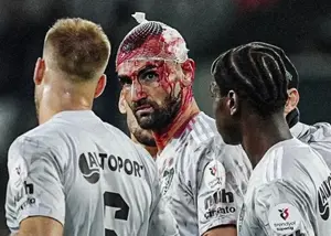 فوران خون و ۱۲ بخیه روی سر سردار!