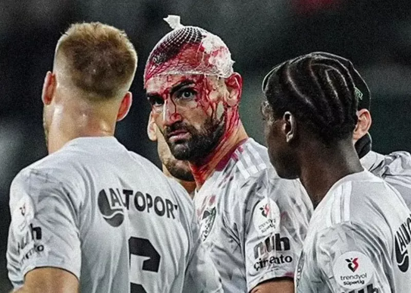 فوران خون و ۱۲ بخیه روی سر سردار!