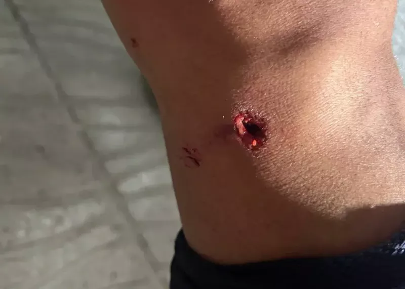 مصدوم آلومینیوم را با آمبولانس بردند(عکس)