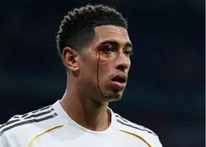 چهره خونین بلینگام در شب مصیبتبار (عکس)