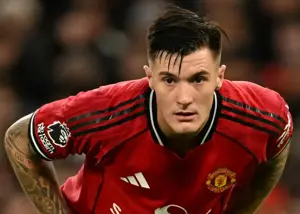 بدشانسی یونایتد: مهاجم گرانقیمت مسموم شد