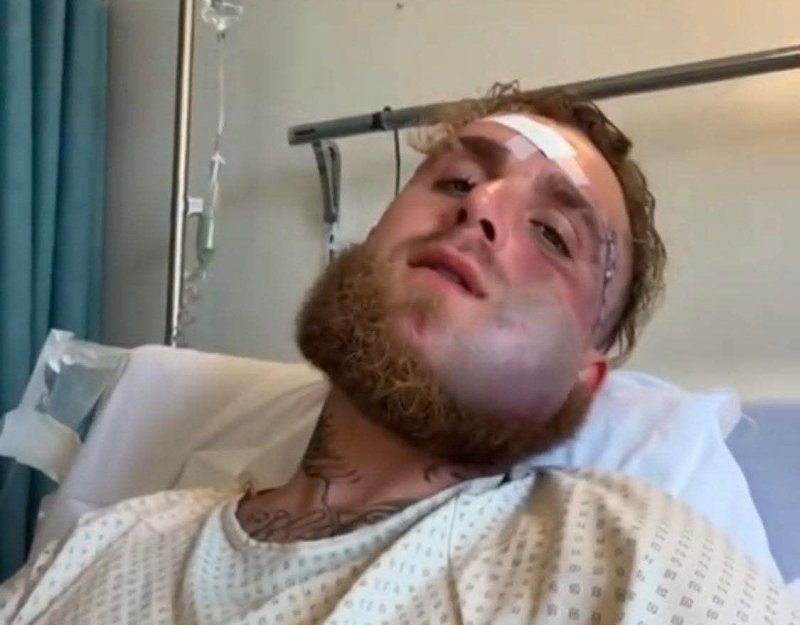 سیلی واقعیت: جاشوا، صورت جیک پاول را پایین آورد!