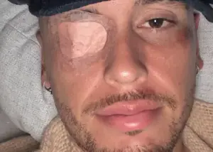 ستاره آرژانتینی از ناحیه صورت فلج شد!