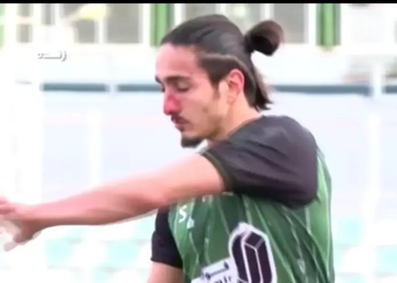 حادثه برای مدافع خیبر، صورت خونی!