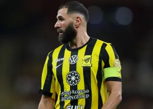 واکنش کونسیسائو به قهر کردن بنزما