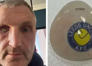 لیدز تا ابد: رونمایی از زیباترین چشم مصنوعی جهان