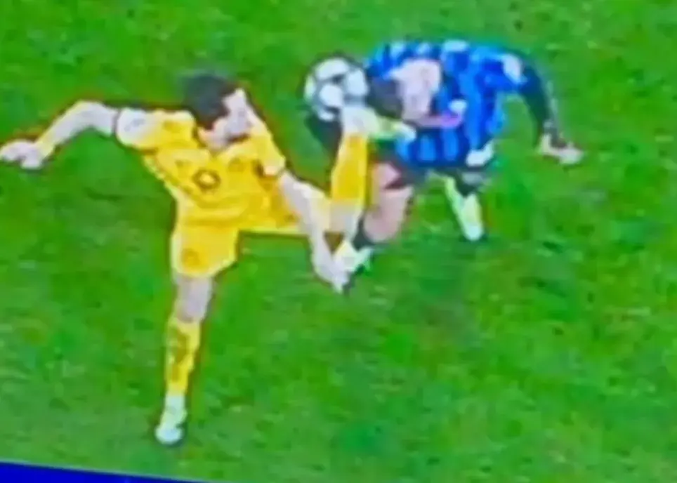 زخم دردناک صورت ستاره آتالانتا: فن کاراته بود؟ (عکس)