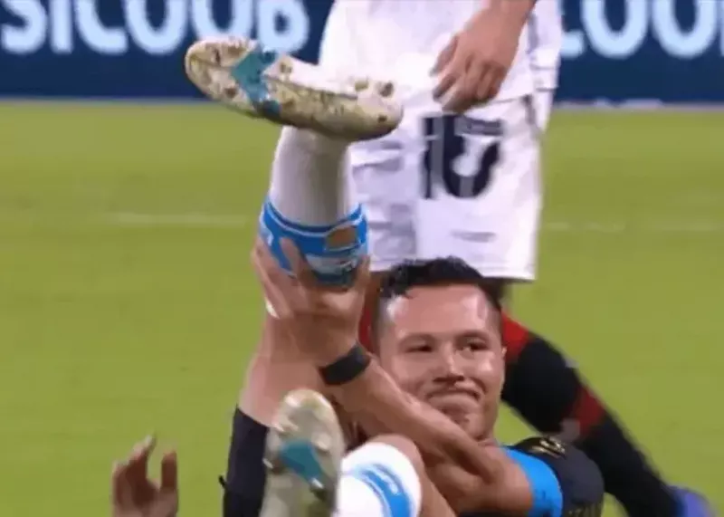 مصدومیت وحشتناک: پای ستاره برزیلی تا شد!