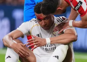 با بانداژ و زخم: امباپه به بازی بایرن رسید