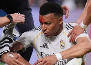 چرا خون‌ریزی امباپه در تلویزیون پخش نشد؟!