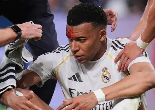 چرا خون‌ریزی امباپه در تلویزیون پخش نشد؟!