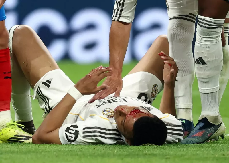 اعتراف کمیته داوران: خطا روی امباپه پنالتی بود