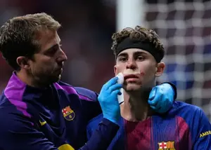 شب پرالتهاب فرمین پس از برخورد شدید