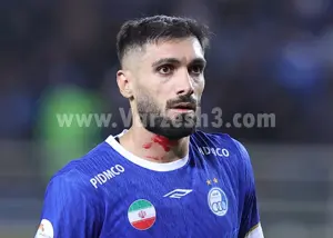 انحصاری: VAR ناخن بلند کنعانی را ندید!