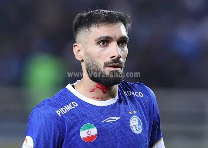 انحصاری: VAR ناخن بلند کنعانی را ندید!